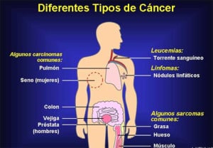 tipos cancer