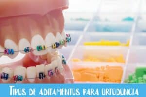 Tipos de aditamentos para ortodoncia